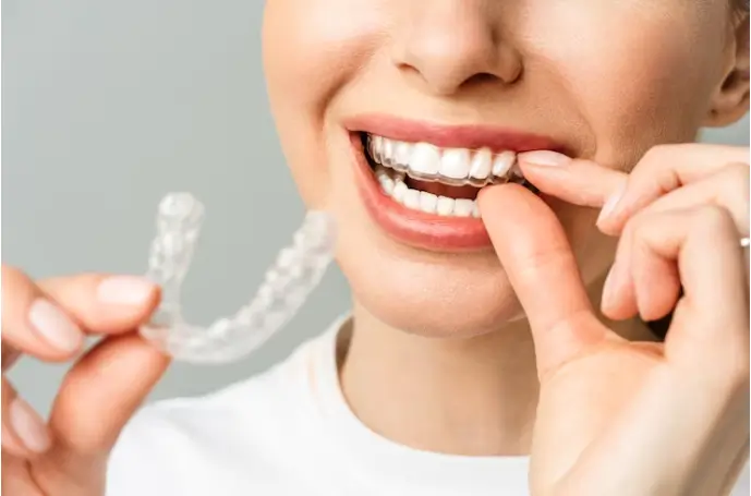 Which Dental Insurance Covers Invisalign